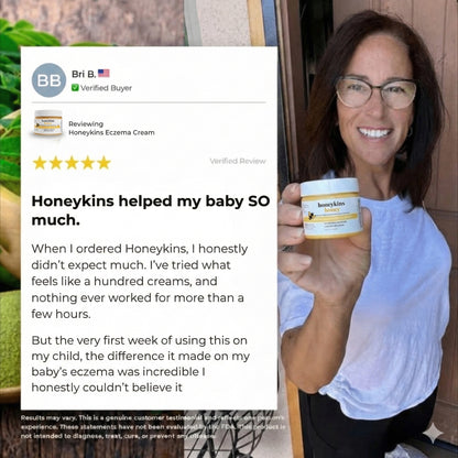 Honeykins™ Eczema Cream