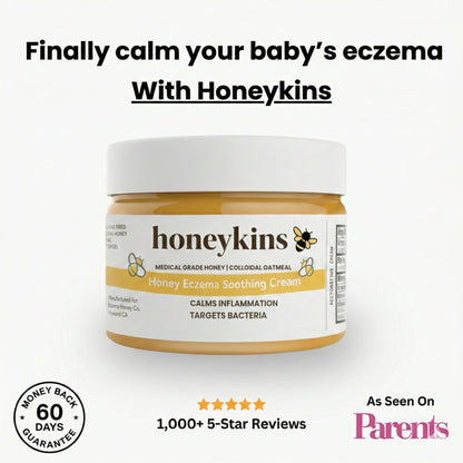 Honeykins™ Eczema Cream