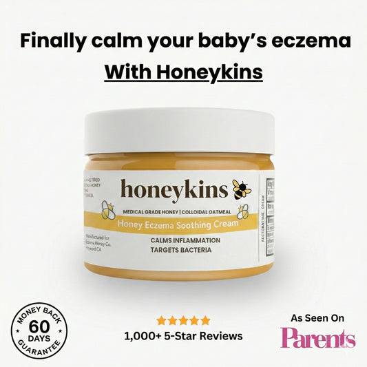 Honeykins™ Eczema Cream