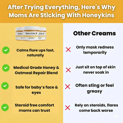 Honeykins™ Eczema Cream