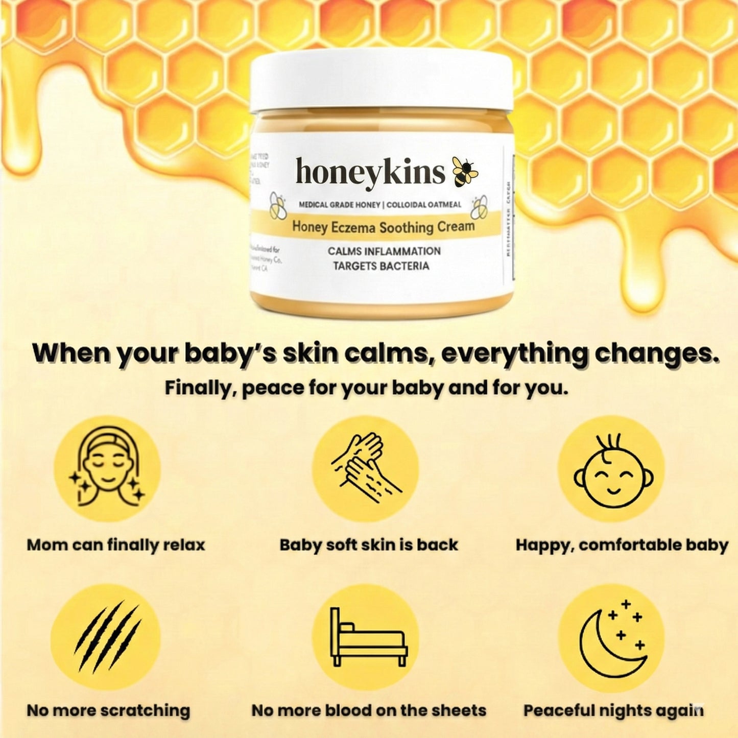 Honeykins™ Eczema Cream