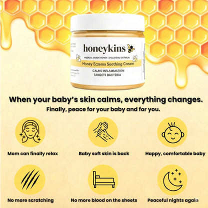 Honeykins™ Eczema Cream