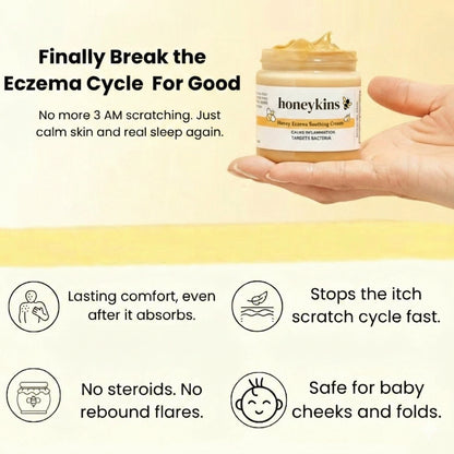 Honeykins™ Eczema Cream
